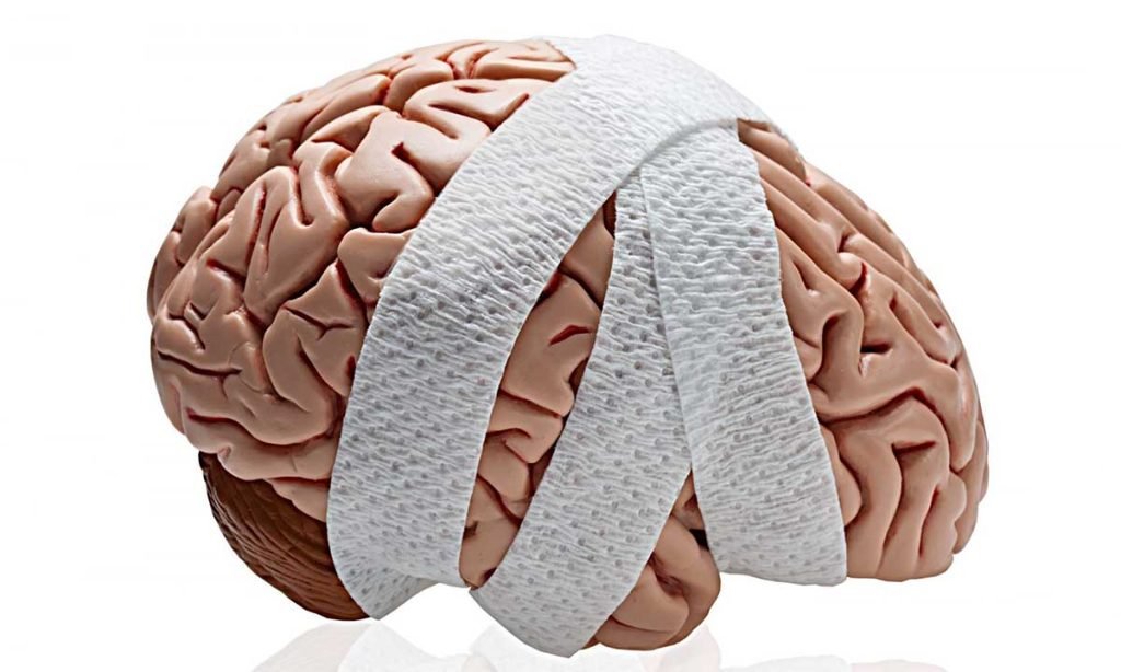 Causes an Acquired Brain Injury